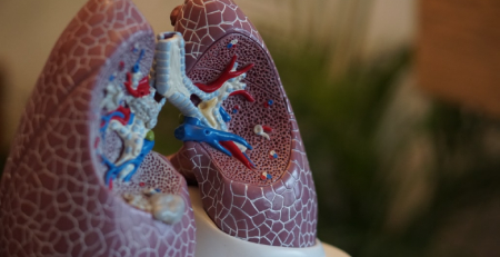 Investigadores estudam nova terapia para hipertensão arterial pulmonar